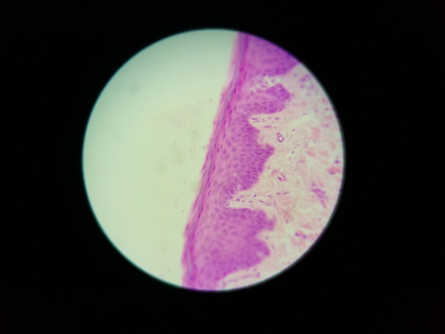 Stratified Squamous Epithelium Slides - Stratified Squamous Epithelium 03 400X